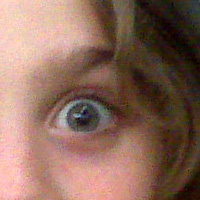 eyeball
