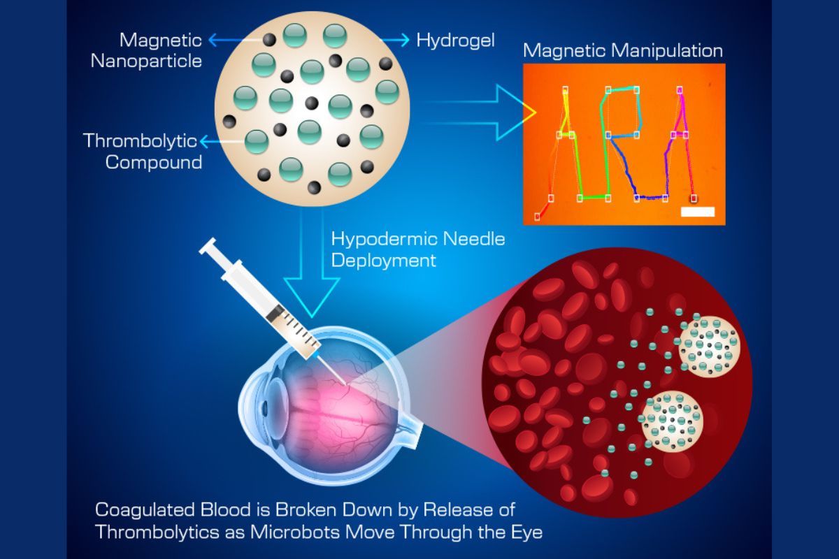 Microbotic Movement Through the Eye