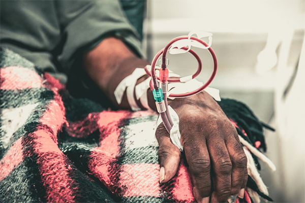 Dialysis patient with IV line resting under a blanket in a medical setting.