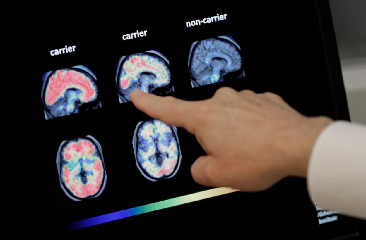 PET scans