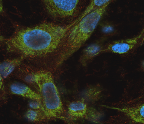 molecular mechanisms graph