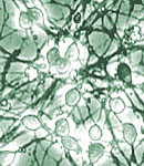 neurons that are healthy