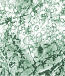 neurons that are degenerating